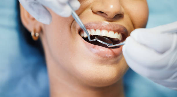 Best Emergency Broken Tooth Repair in Bowie, TX