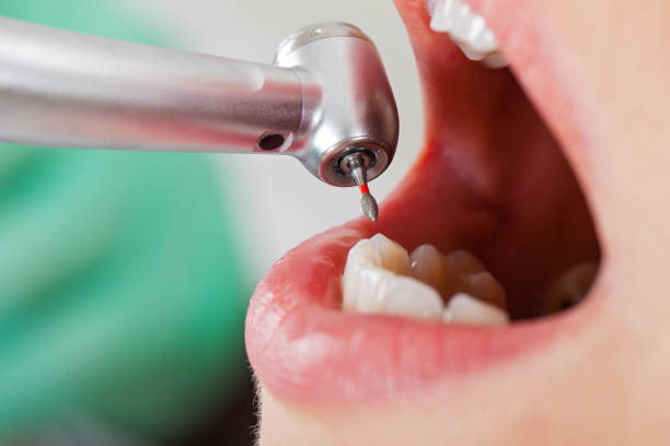 Best After-Hours Emergency Dentist in Bowie, TX